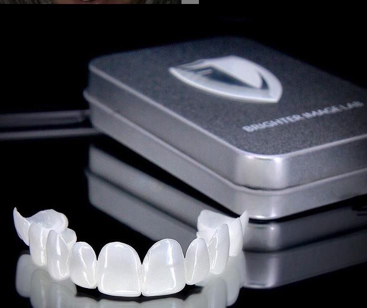 Lentes Dentais White ®  Kit Superior + Inferior (TOTALMENTE AJUSTÁVEL A TODAS ARCADAS DENTÁRIAS)
