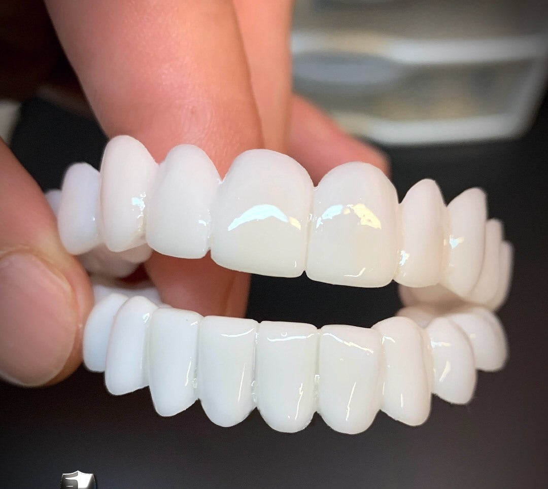 [O PAR] Lentes DentalWhite ®  Kit Superior + Inferior (TOTALMENTE AJUSTÁVEL A TODAS ARCADAS DENTÁRIAS)
